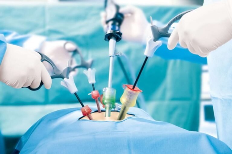 Laparoscopic-surgery
